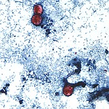 As cyclospora illnesses surge to a record, Michigan officials eye lettuce as a possible cause