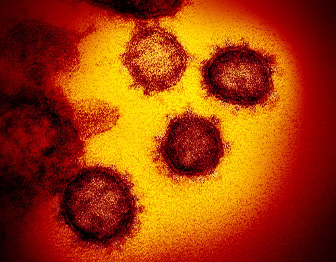 FILE - This undated electron microscope image made available by the U.S. National Institutes of Health in February 2020 shows the Novel Coronavirus SARS-CoV-2, the virus causes COVID-19. A new type of coronavirus test offers a cheaper, quicker way to screen for infections, moving the U.S. toward the kind of mass screening that experts say is essential to returning millions of Americans to school and work. But the first so-called antigen test _ announced Saturday, may 9, 2020 by the Food and Drug Administration _ is not quite the kind sought by top government health officials. It is less accurate than the current gold standard for testing and can only be run on specialized equipment. (NIAID-RML via AP)